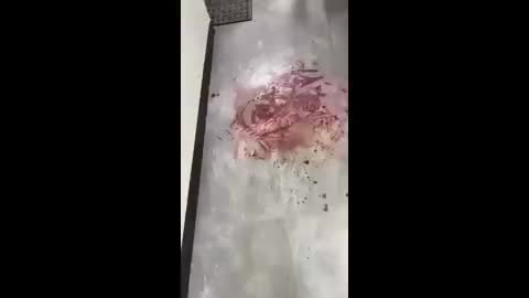 Guy at Penn State tweaking and cut his penis off