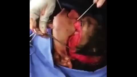 Traumatic facial injury and visualisation of anatomy beneath