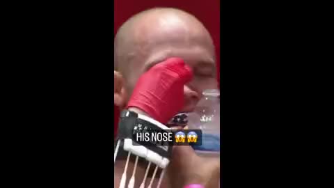 Tilted: MMA Fighter Nose Broke During A Match & Know It's